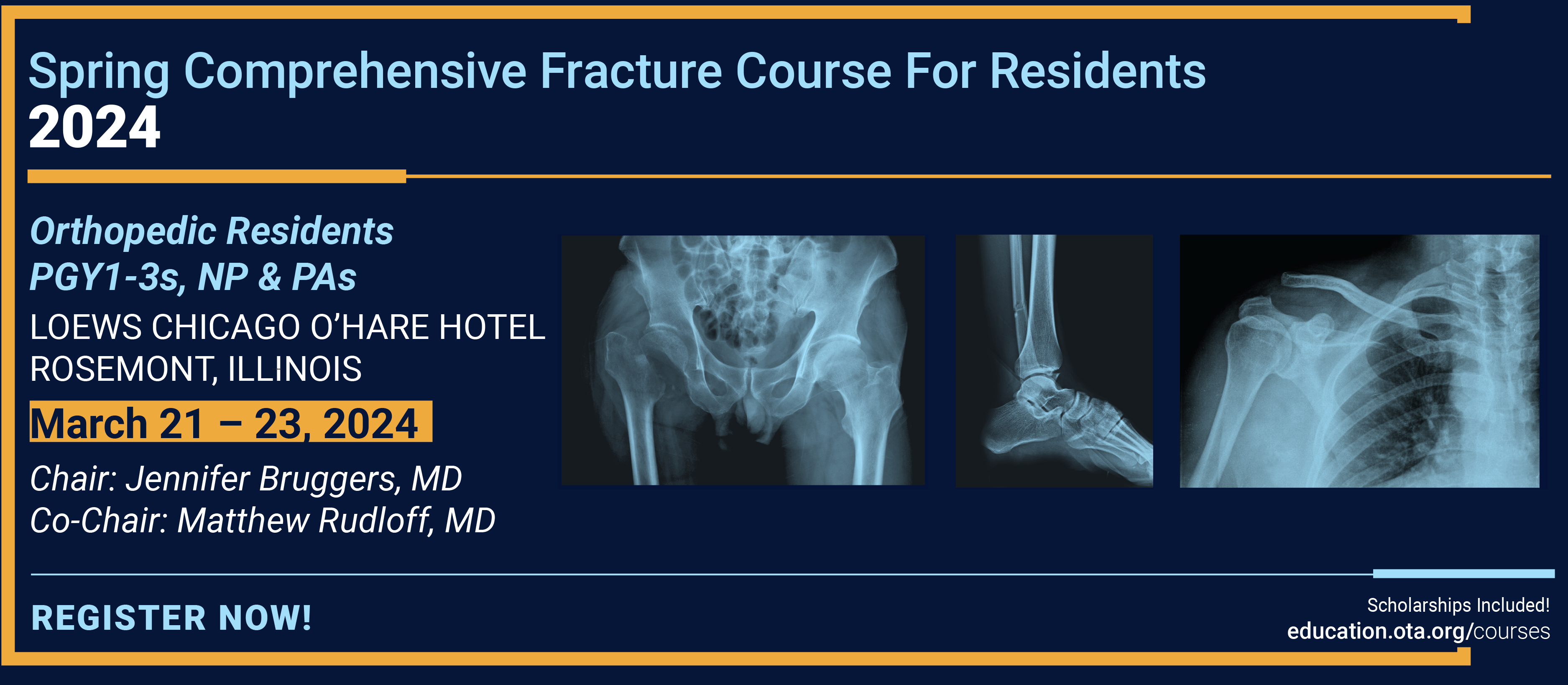 2024 OTA Spring Comprehensive Fracture Course for Residents