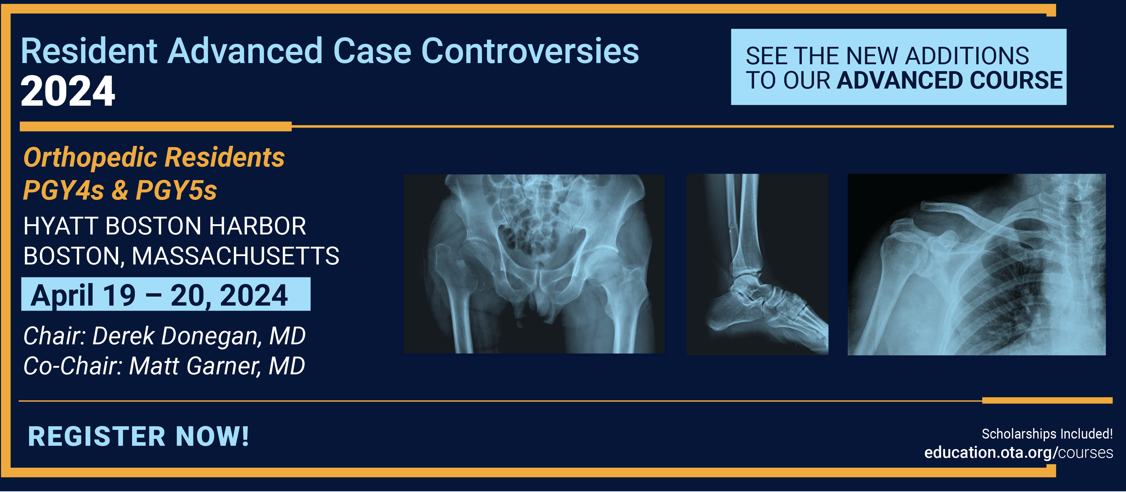 2024 Resident Advanced Case Controversies